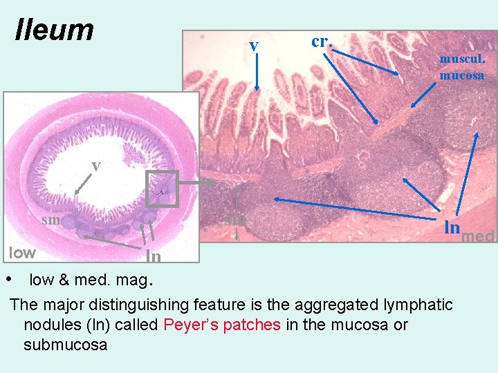 Ileum v cr. muscul. mucosa v sm sm low lnmed ln • low &