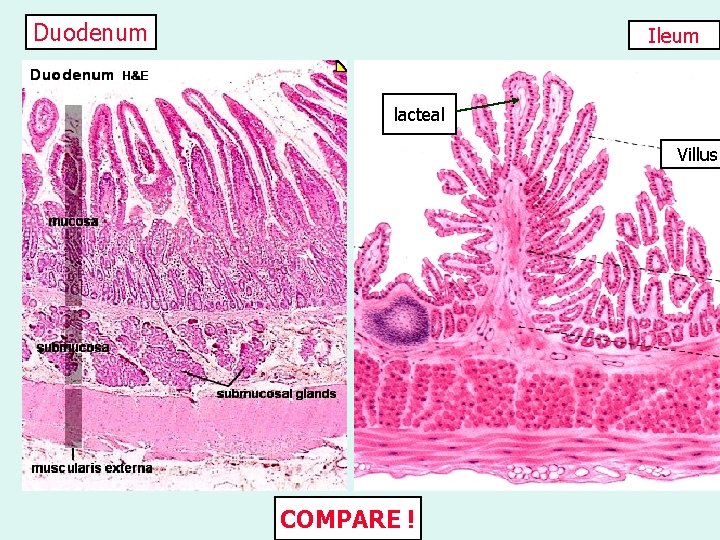 Duodenum Ileum lacteal Villus COMPARE ! 