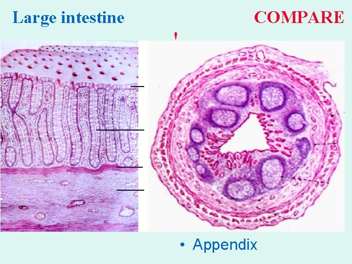 Large intestine COMPARE ! • Appendix 