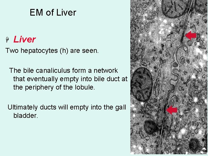 EM of Liver H Liver Two hepatocytes (h) are seen. The bile canaliculus form