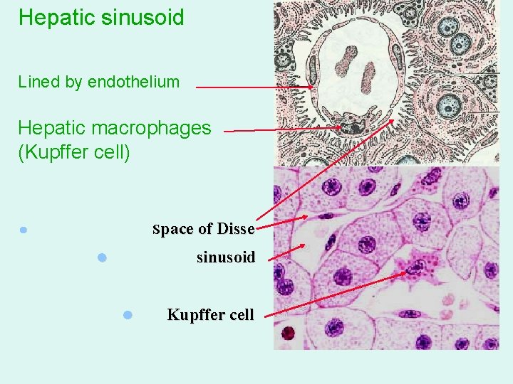 Hepatic sinusoid Lined by endothelium Hepatic macrophages (Kupffer cell) Space of Disse l sinusoid