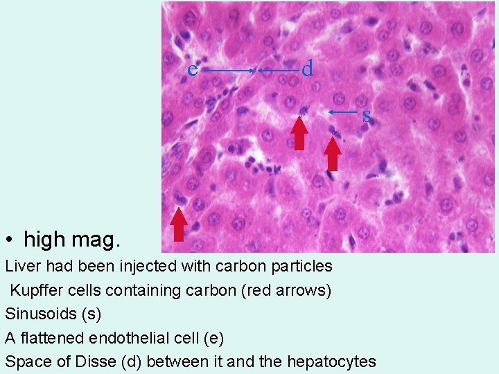 e d s • high mag. Liver had been injected with carbon particles Kupffer
