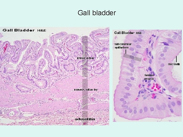 Gall bladder 