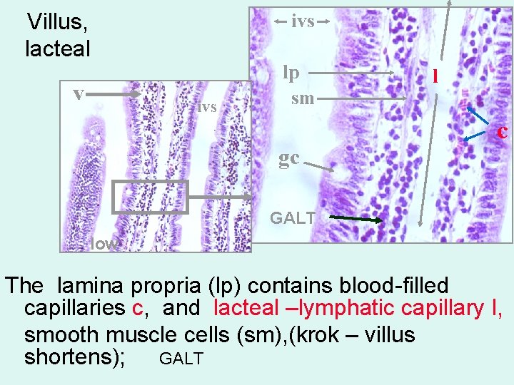 Villus, lacteal v ivs lp sm gc l c GALT low The lamina propria