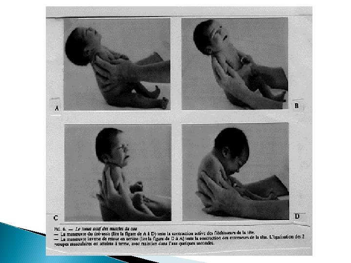 Le Dveloppement Psychomoteur De Lenfant Psychomotricit Psycho Fait