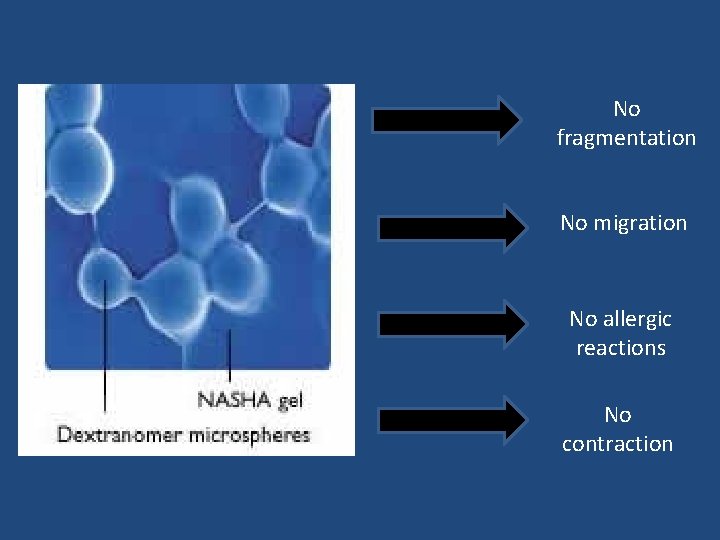 No fragmentation No migration No allergic reactions No contraction 