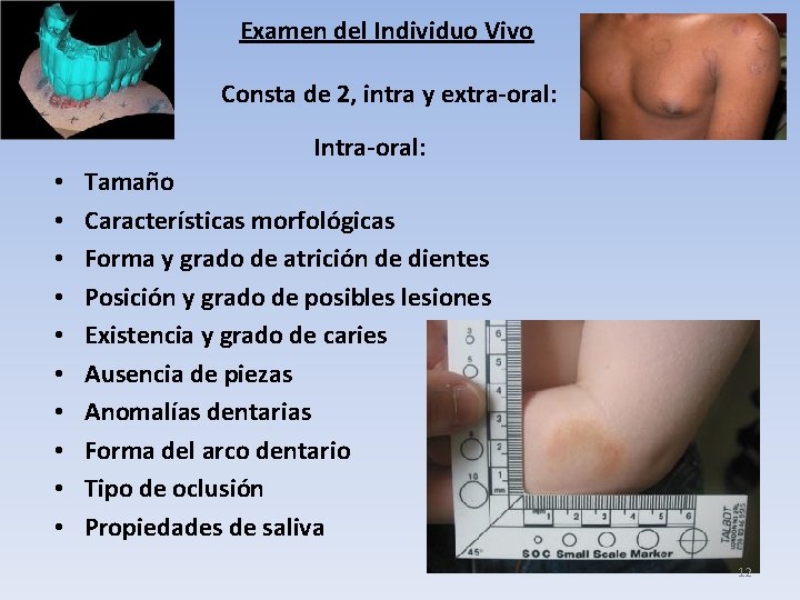 Examen del Individuo Vivo Consta de 2, intra y extra-oral: Intra-oral: • • •