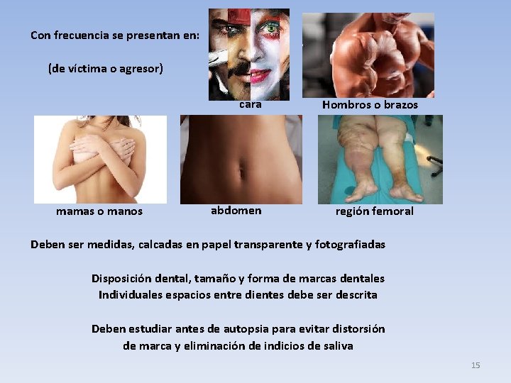 Con frecuencia se presentan en: (de víctima o agresor) cara mamas o manos abdomen