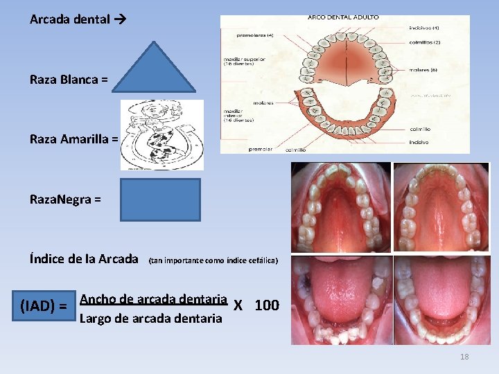 Arcada dental Raza Blanca = Raza Amarilla = Raza. Negra = Índice de la