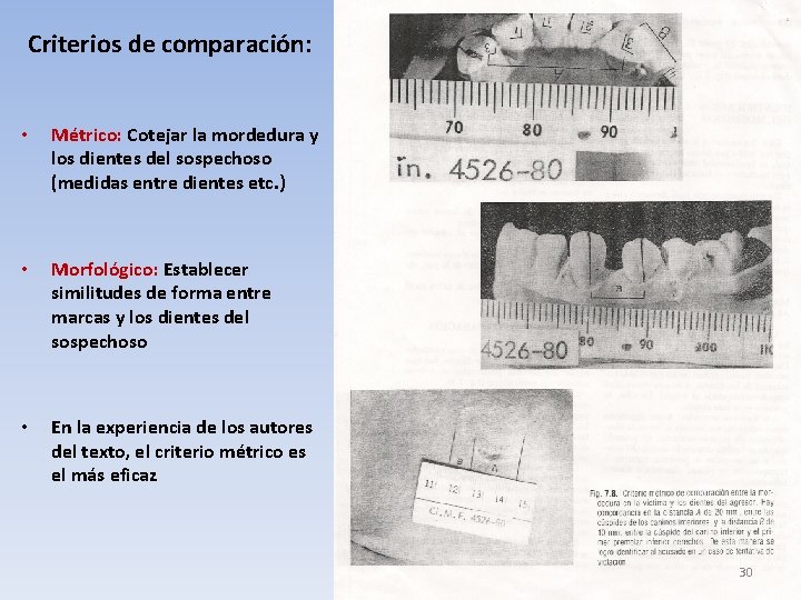 Criterios de comparación: • Métrico: Cotejar la mordedura y los dientes del sospechoso (medidas