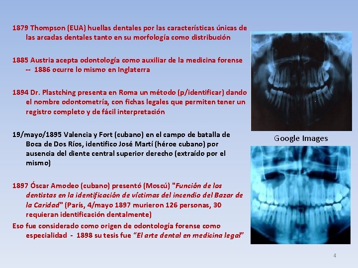 1879 Thompson (EUA) huellas dentales por las características únicas de las arcadas dentales tanto