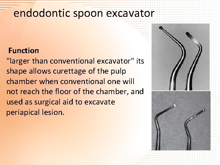 endodontic spoon excavator Function "larger than conventional excavator" its shape allows curettage of the