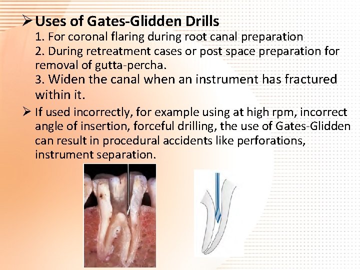 Ø Uses of Gates-Glidden Drills 1. For coronal flaring during root canal preparation 2.
