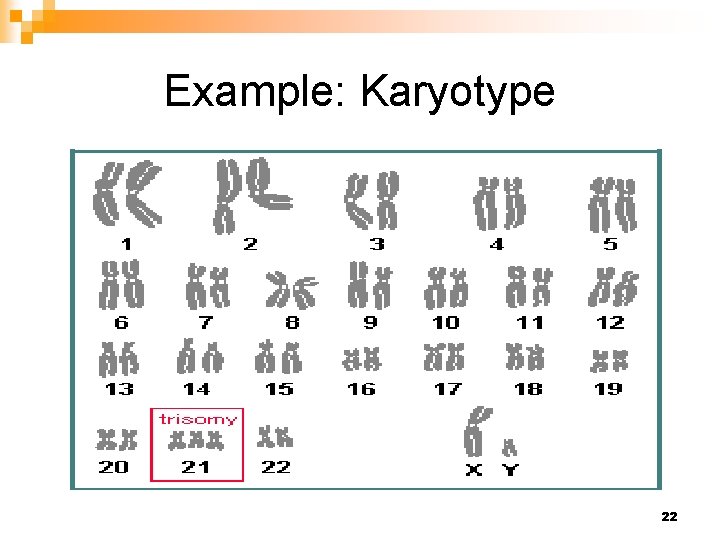 Example: Karyotype 22 