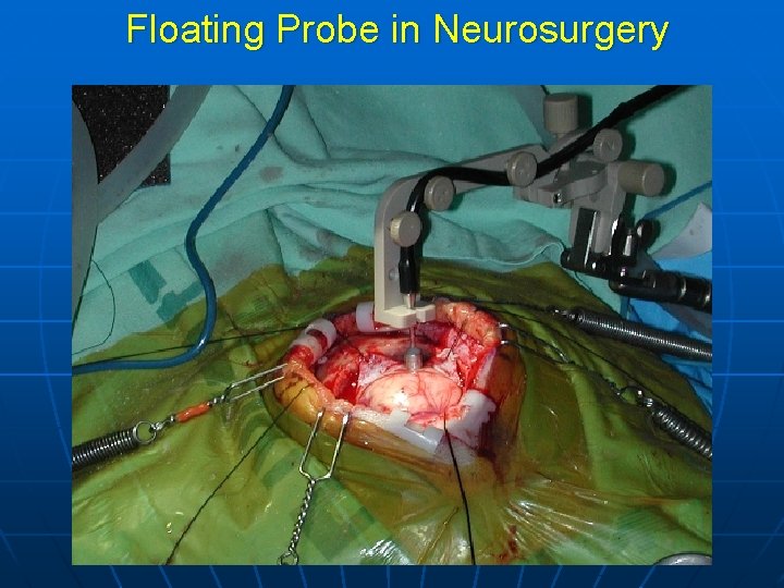 Floating Probe in Neurosurgery 