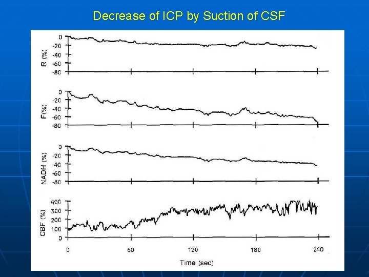 Decrease of ICP by Suction of CSF 