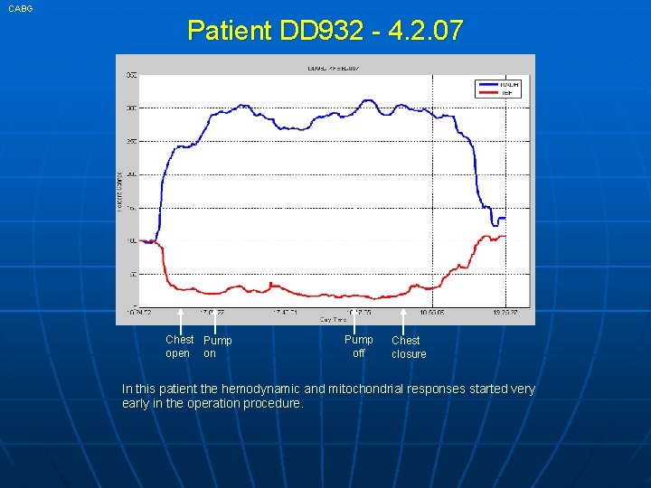 CABG Patient DD 932 - 4. 2. 07 38 min Chest Pump open on