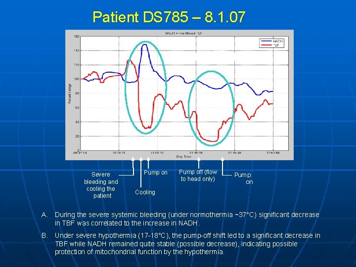 Patient DS 785 – 8. 1. 07 37 min A B Severe bleeding and