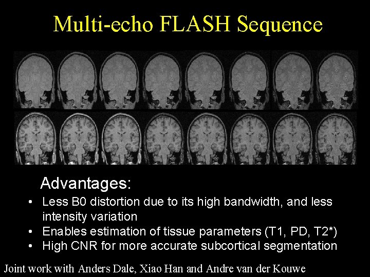 Multi-echo FLASH Sequence Advantages: • Less B 0 distortion due to its high bandwidth,
