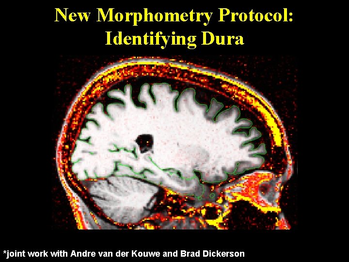 New Morphometry Protocol: Identifying Dura *joint work with Andre van der Kouwe and Brad