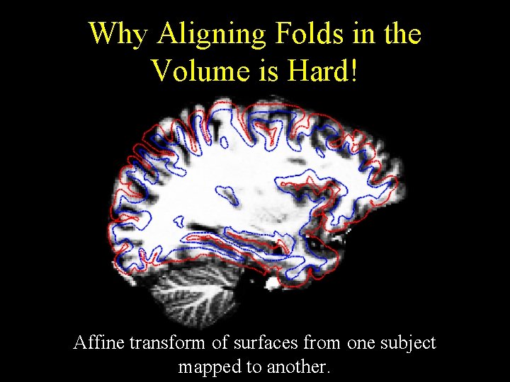 Why Aligning Folds in the Volume is Hard! Affine transform of surfaces from one