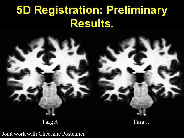 5 D Registration: Preliminary Results. Target Joint work with Gheorghe Postelnicu Target 