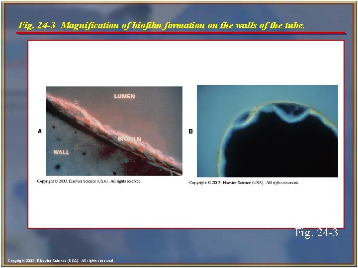 Fig. 24 -3 Magnification of biofilm formation on the walls of the tube. Fig. Fig. 24 -3 Magnification of biofilm formation on the walls of the tube. Fig.