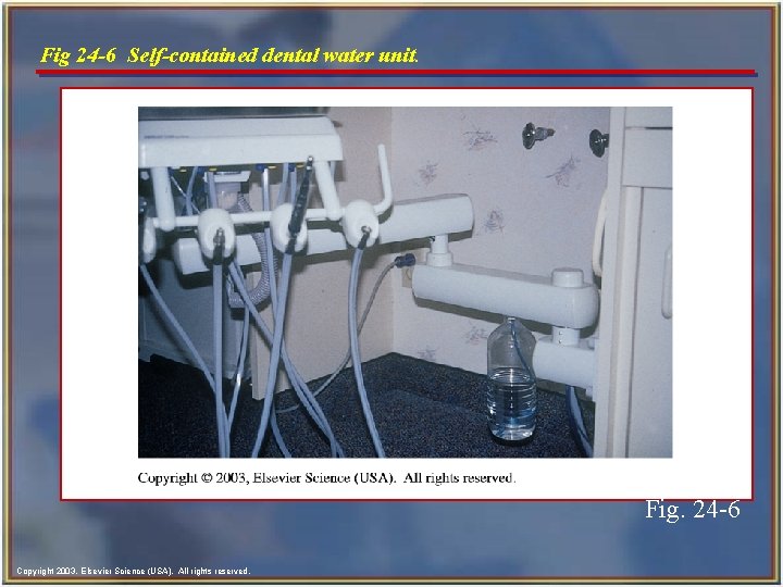 Fig 24 -6 Self-contained dental water unit. Fig. 24 -6 Copyright 2003, Elsevier Science Fig 24 -6 Self-contained dental water unit. Fig. 24 -6 Copyright 2003, Elsevier Science