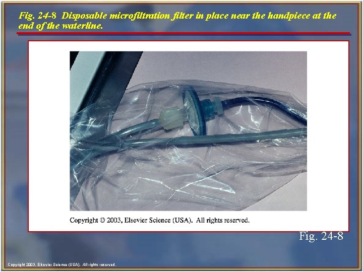 Fig. 24 -8 Disposable microfiltration filter in place near the handpiece at the end Fig. 24 -8 Disposable microfiltration filter in place near the handpiece at the end