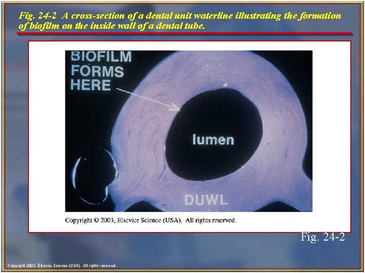Fig. 24 -2 A cross-section of a dental unit waterline illustrating the formation of Fig. 24 -2 A cross-section of a dental unit waterline illustrating the formation of