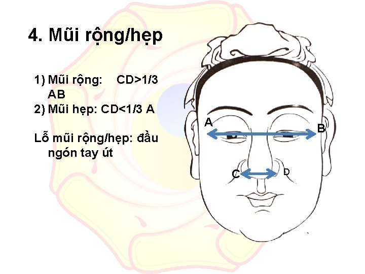 4. Mũi rộng/hẹp 1) Mũi rộng: CD>1/3 AB 2) Mũi hẹp: CD<1/3 A A