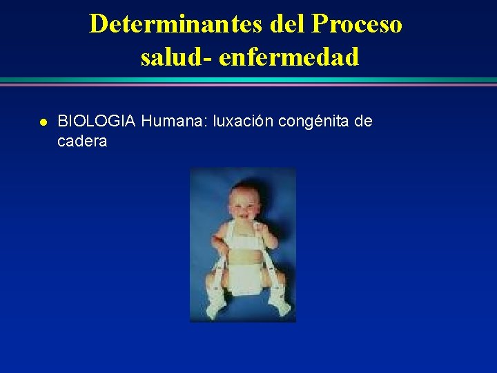 Determinantes del Proceso salud- enfermedad l BIOLOGIA Humana: luxación congénita de cadera Determinantes del Proceso salud- enfermedad l BIOLOGIA Humana: luxación congénita de cadera
