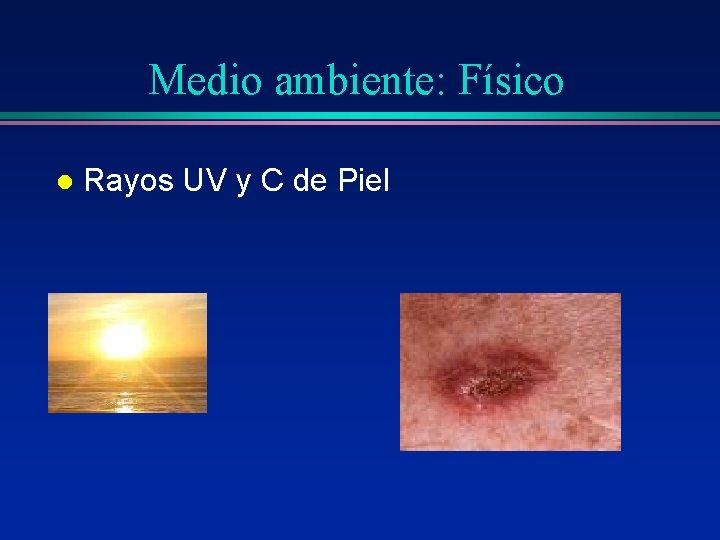 Medio ambiente: Físico l Rayos UV y C de Piel Medio ambiente: Físico l Rayos UV y C de Piel