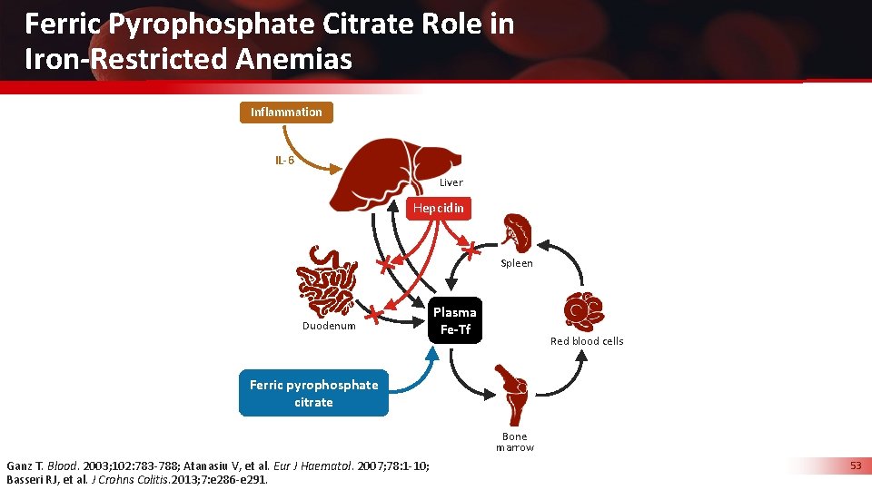 Ferric Pyrophosphate Citrate Role in Iron-Restricted Anemias Inflammation IL-6 Liver Hepcidin Spleen Duodenum Plasma