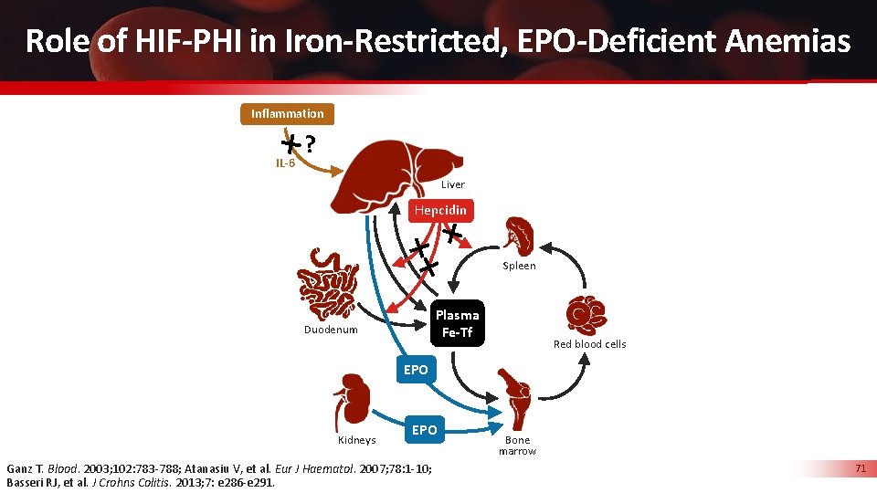 Role of HIF-PHI in Iron-Restricted, EPO-Deficient Anemias Inflammation IL-6 ? Liver Hepcidin Spleen Plasma