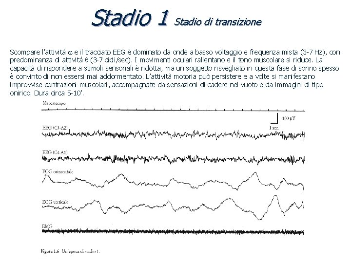 Stadio 1 Stadio di transizione Scompare l’attività a e il tracciato EEG è dominato