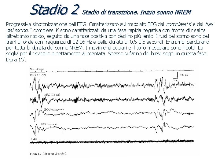 Stadio 2 Stadio di transizione. Inizio sonno NREM Progressiva sincronizzazione dell’EEG. Caratterizzato sul tracciato