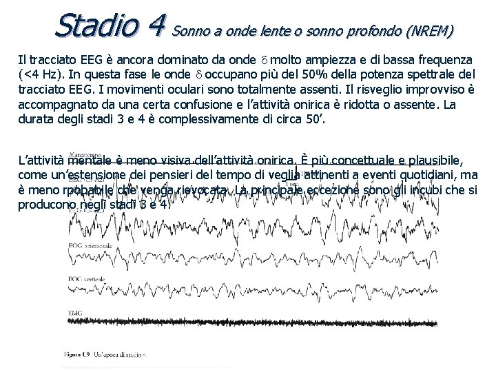 Stadio 4 Sonno a onde lente o sonno profondo (NREM) Il tracciato EEG è