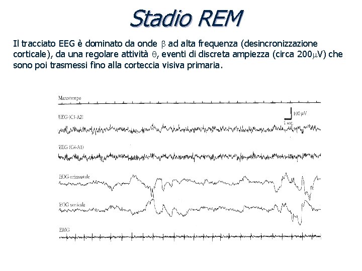 Stadio REM Il tracciato EEG è dominato da onde b ad alta frequenza (desincronizzazione