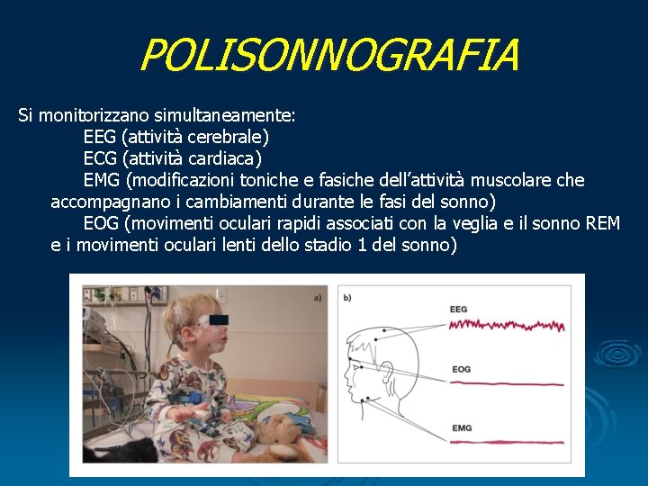 POLISONNOGRAFIA Si monitorizzano simultaneamente: EEG (attività cerebrale) ECG (attività cardiaca) EMG (modificazioni toniche e