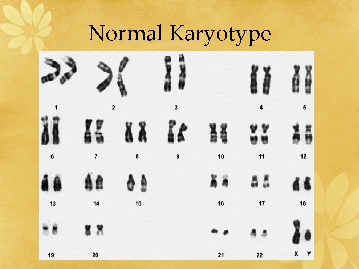 Normal Karyotype 