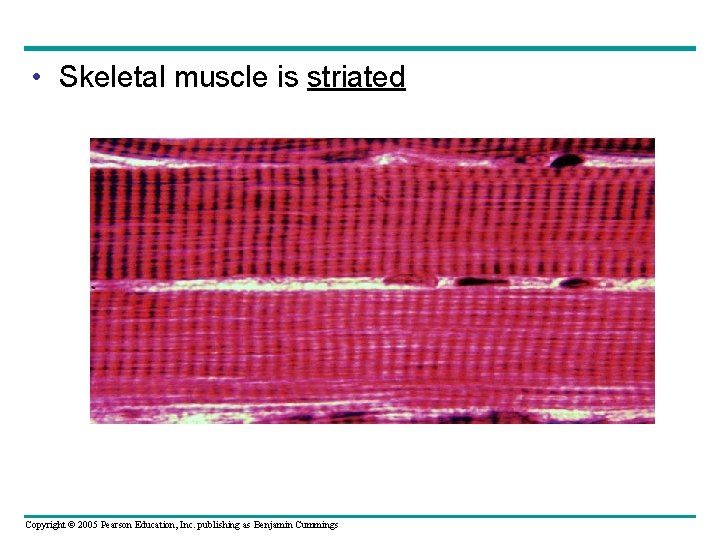  • Skeletal muscle is striated Copyright © 2005 Pearson Education, Inc. publishing as