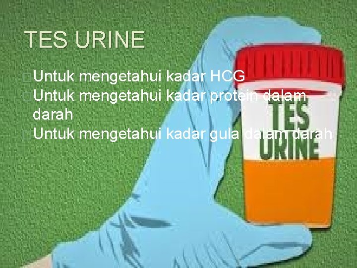 TES URINE �Untuk mengetahui kadar HCG �Untuk mengetahui kadar protein dalam darah �Untuk mengetahui
