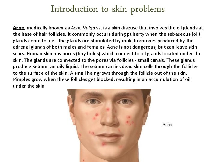 Introduction to skin problems Acne, medically known as Acne Vulgaris, is a skin disease Introduction to skin problems Acne, medically known as Acne Vulgaris, is a skin disease