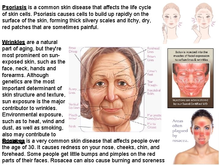 Psoriasis is a common skin disease that affects the life cycle of skin cells. Psoriasis is a common skin disease that affects the life cycle of skin cells.