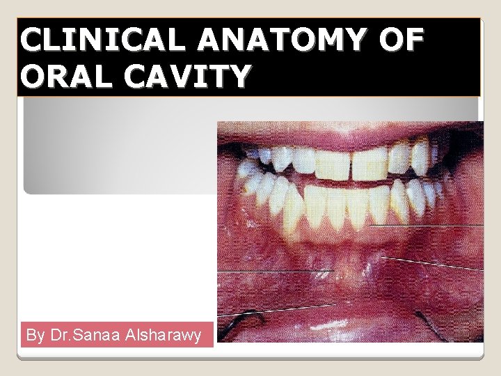 CLINICAL ANATOMY OF ORAL CAVITY By Dr. Sanaa Alsharawy 