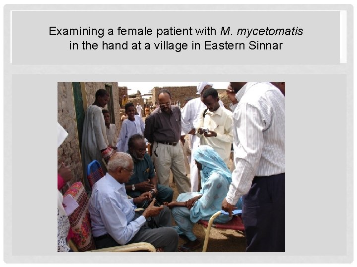 Examining a female patient with M. mycetomatis in the hand at a village in