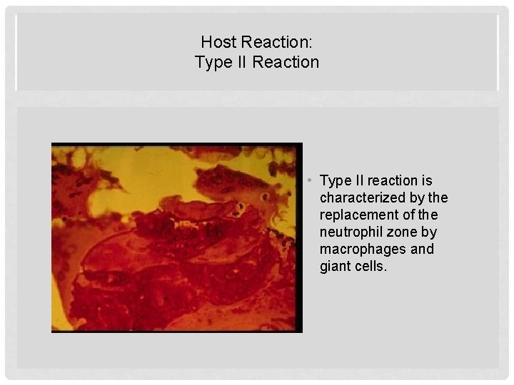 Host Reaction: Type II Reaction HOST REACTION: TYPE II REACTION • Type II reaction