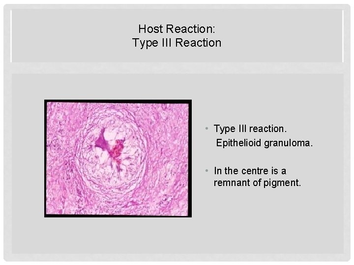 Host Reaction: Type III Reaction HOST REACTION: TYPE II REACTION • Type III reaction.