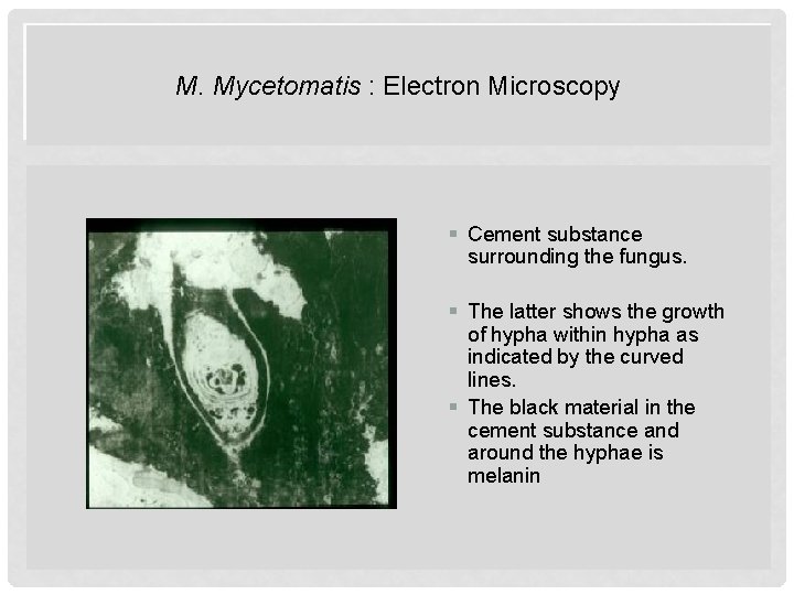 M. Mycetomatis : Electron Microscopy § Cement substance surrounding the fungus. § The latter